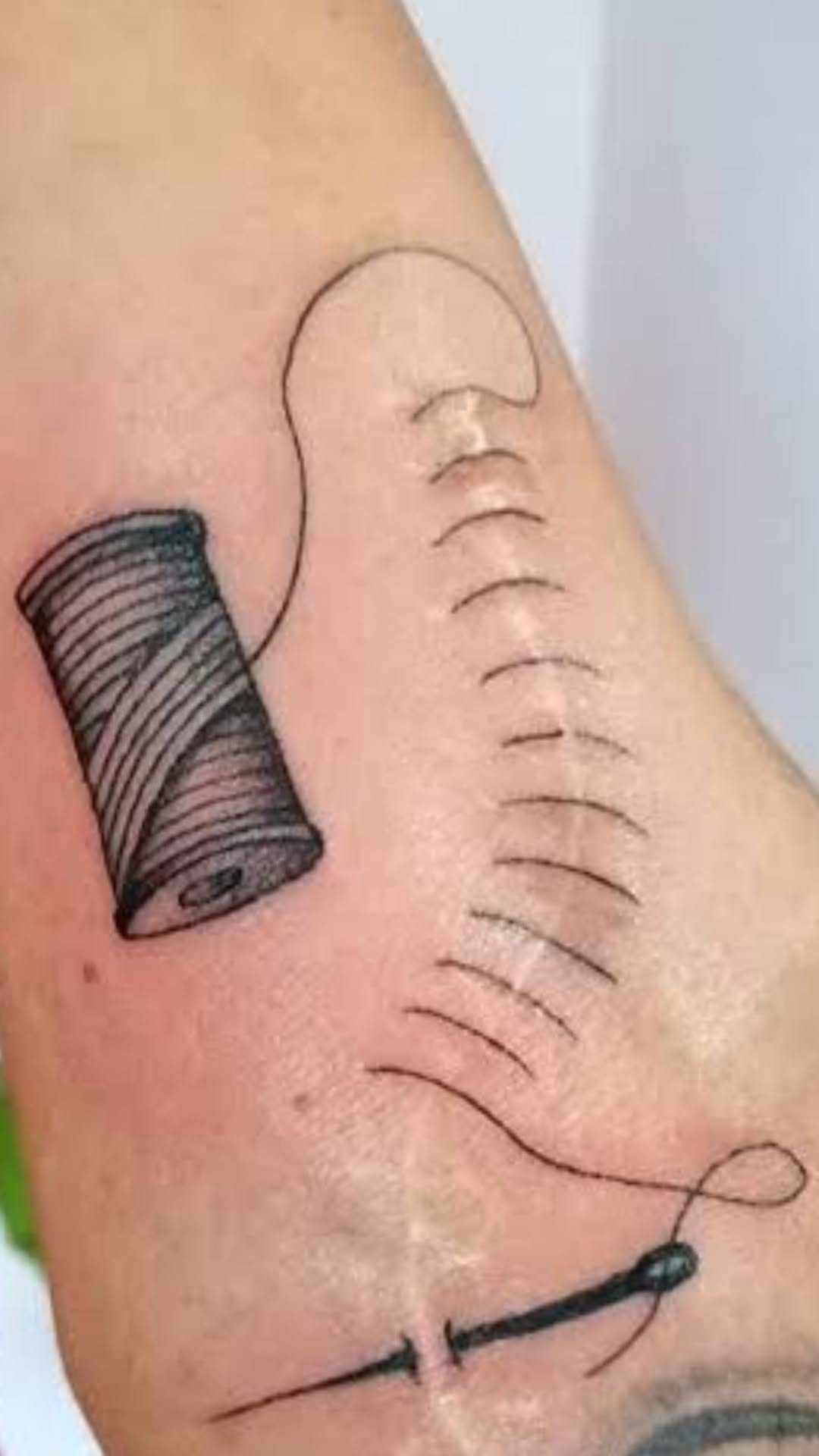 Cover Up Tattoo Pattern: 9 Ways to Hide Old Ink or Scars 7 A black ink tattoo of a thread spool and needle stitching over a surgical scar.