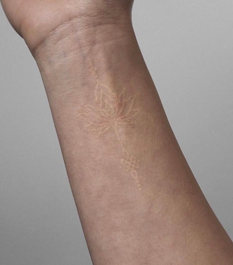 White Ink Water Lily Tattoo: 7 Ideas for Subtle Floral Ink 1 A delicate white ink water lily outline tattoo on a person's forearm.